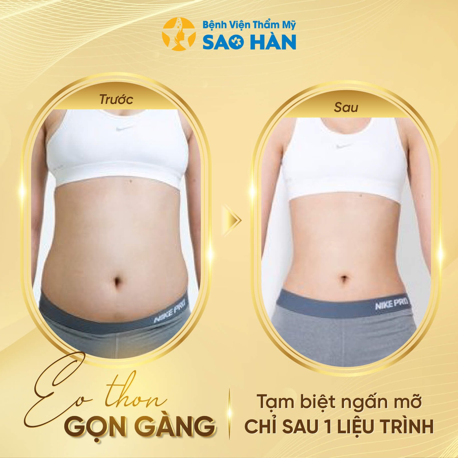 4 giảm béo-02
